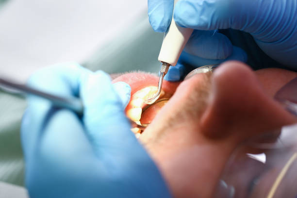 Best Emergency Care for Gum Disease in Brackettville, TX