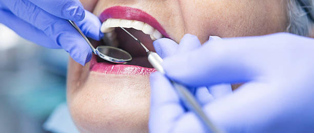 Best Dental Abscess Treatment in Brackettville, TX